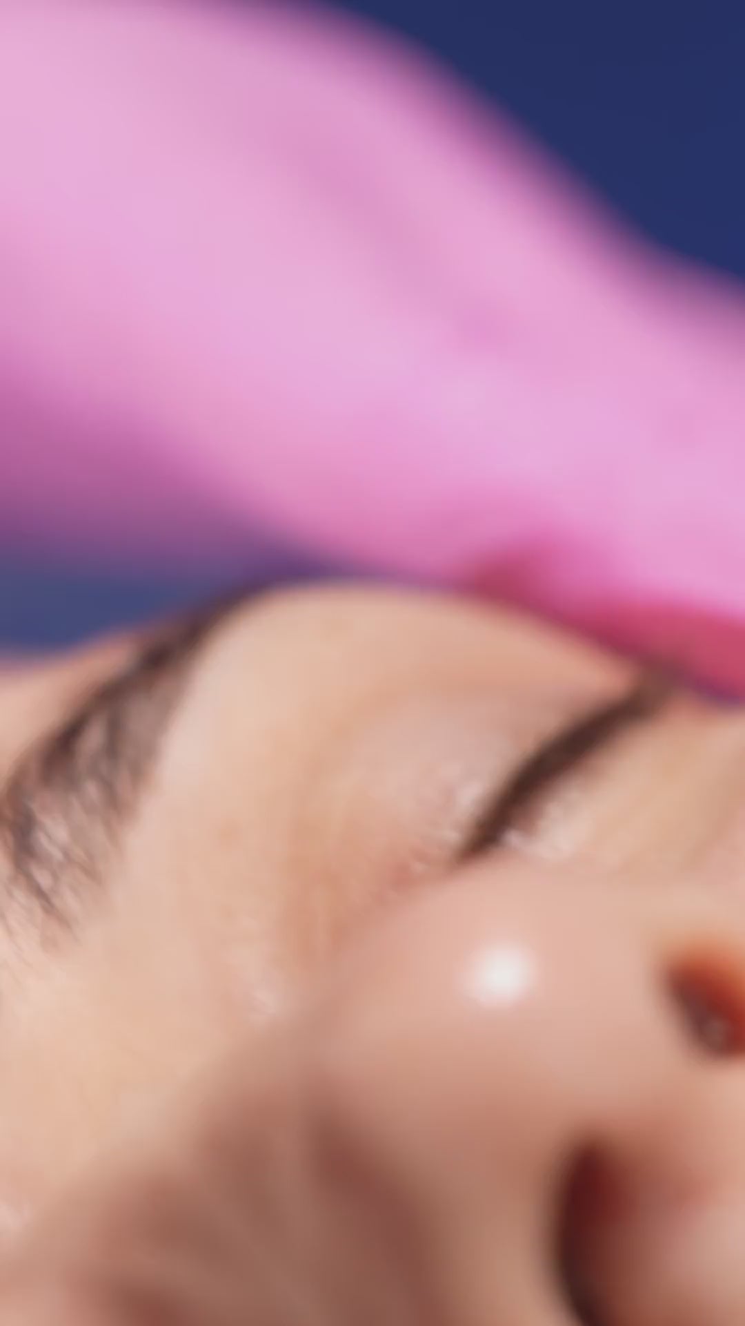 Trial Facial Treatment - Skin Spicules Longevity